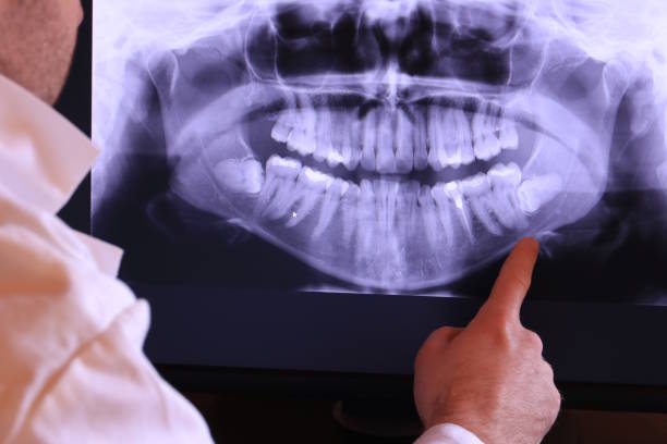 Best Emergency Broken Tooth Repair in Waldo, FL